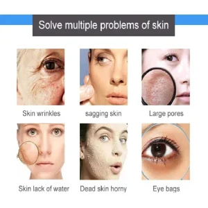 Aparat combina 12 in 1 hidradermabraziune, ultrasunete, oxigenare, oxygen facial Bio,Aqua Peeling, AQUAFacial - imagine 5