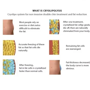 Aparat Criolipoliza 360, Criolipolysis, RF cavitatie, aparat de slabit, fat freezing machine, reducere celulita, pierdere in greutate - imagine 6