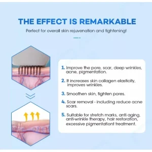 Aparat 2 in1 Golden Microneedeling si ciocan rece, tratament antiacneic, RF lifting, indepartare vergeturi si cicatrici, skin rejuvenation - imagine 6