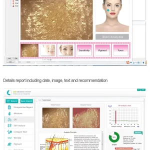Analizator scaner facial 3D pentru testarea pielii cu USB pentru analiza de piele facială, analiza ridurilor pielii, analiza pigmentarii, analiza acneei, analiza umidității pielii, RGB+UV+PL - imagine 2