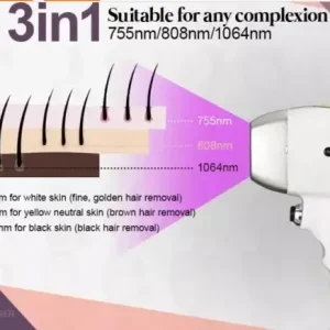 Aparat epilare definitiva cu focusare inteligenta a energiei Laser Dioda IEF 4000 W, putere manipul 1800 W, 4 Lungimi 940nm, 755nm, 808nm, 1064nm, 50 milioane impulsuri - imagine 4